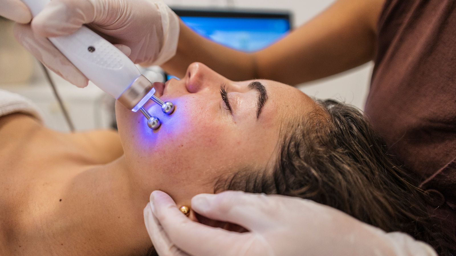 restylane dermal fillers